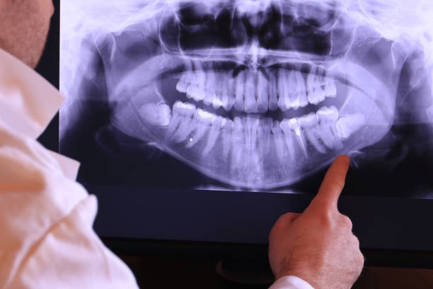 Best Dental Abscess Treatment in Patterson Tract, CA