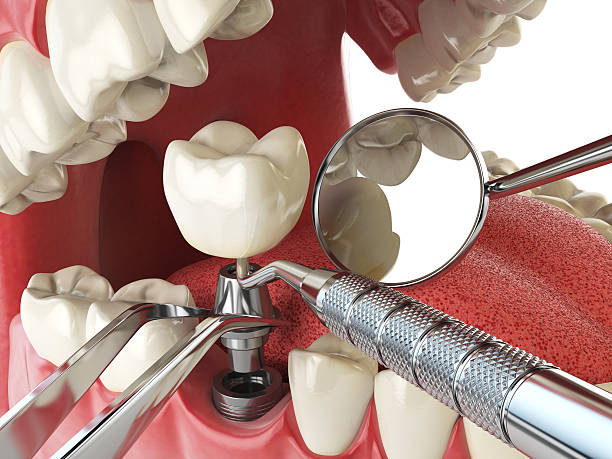 Best Emergency Dental Care for Sports Injuries in Patterson Tract, CA