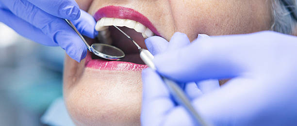 Best Walk-In Emergency Dental Services in Patterson Tract, CA